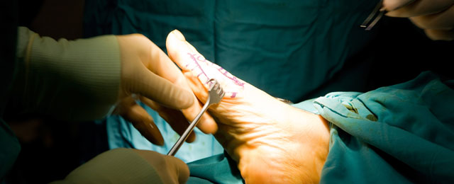 foot-surgery